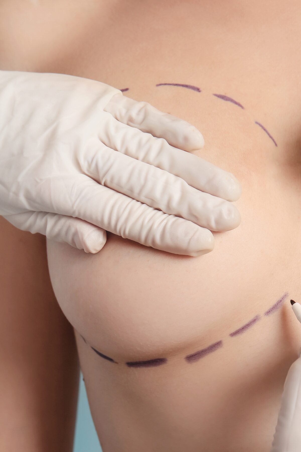 Social media management for cosmetic surgeons by Dolly Social